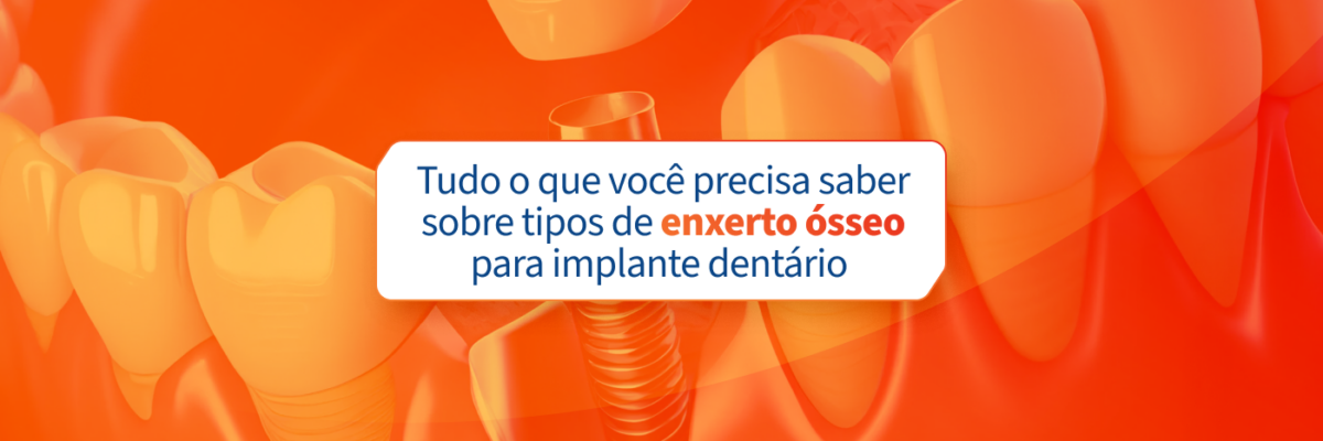 Imagem ilustrativa explicando o que é um expertôseo para implante dentário, com foco na importância da saúde bucal e procedimentos odontológicos.