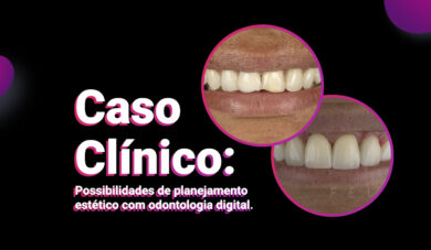 Odontologia digital: possibilidades de planejamento estético