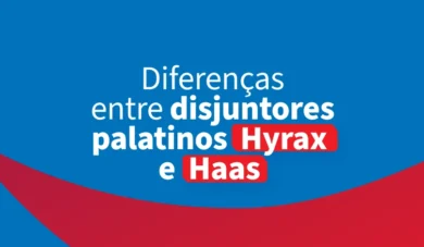 Aparelhos ortodônticos V: disjuntores palatinos Hyrax e Haas