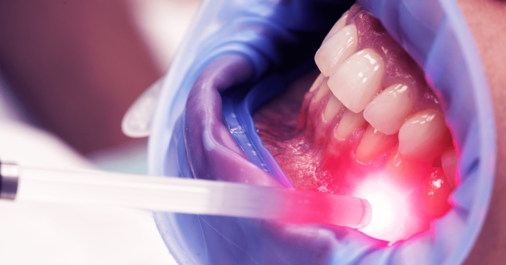 banner - dentista realizando a laserterapia no paciente após colocação de implante dentário