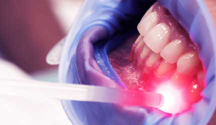 A influência da Laserterapia no pós-operatório de implante dentário