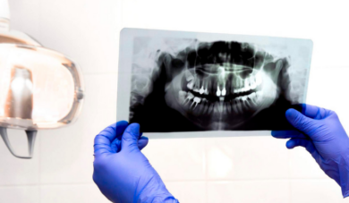 Especialização em radiologia: o que preciso saber?