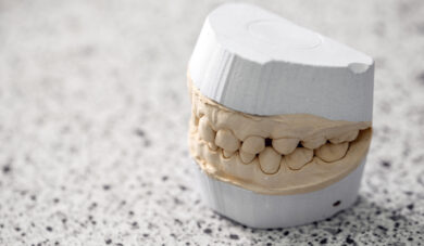 Qual a importância que você dá aos modelos de gesso?