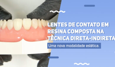 Uma nova modalidade estética para lentes de contato