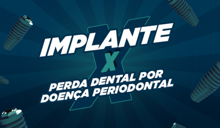 Implante x Perda dental por doença periodontal