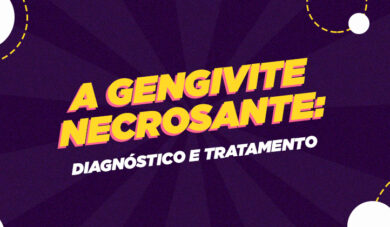 Tudo o que você precisa saber sobre GUNA