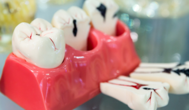 Tratamento endodôntico na odontopediatria