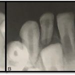 radiografia odontológica