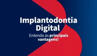 Odontologia digital como aliada da implantodontia