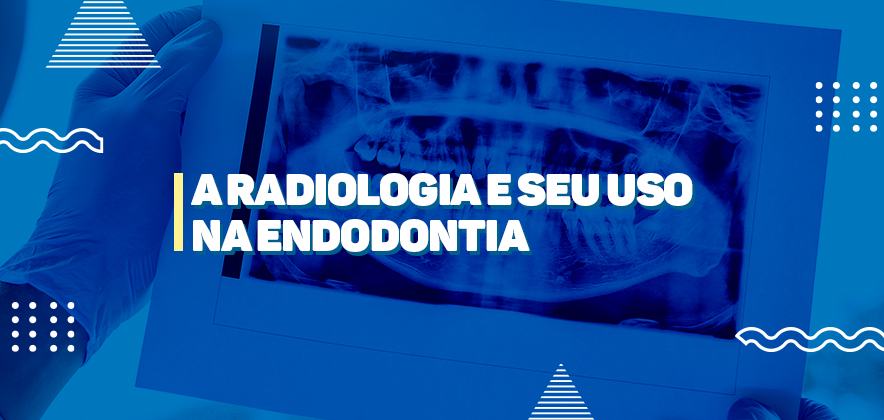 Escolhendo filmes radiográficos: tudo que você precisa saber - Blog ...