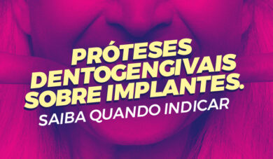 Prótese dentogengival é a melhor opção?