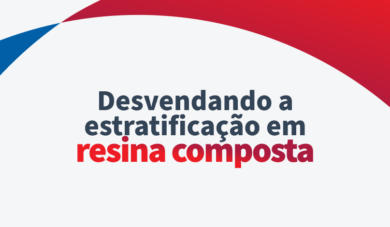 Estratificação em resina composta: por que fazer?