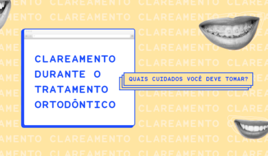 Clareamento na ortodontia: antes ou depois do tratamento?