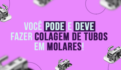 Colagem de tubos em molares, perca o medo dessa tarefa simples!