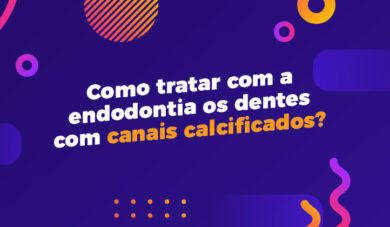 Como é o tratamento com canais calcificados?