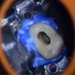 Imagem detalhada da parte interna de um dispositivo, mostrando componentes eletrônicos com uma mangueira azul e uma peça branca visível.