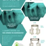 Grampo invisível Indusbello que não aparece na radiografia. Ideal para melhorar a visualização e otimizar tempo e economia.