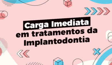 Carga Imediata como tratamento em Implantodontia