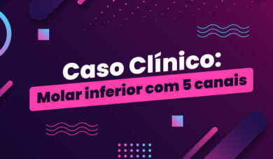 Caso Clínico: molar inferior com 5 canais