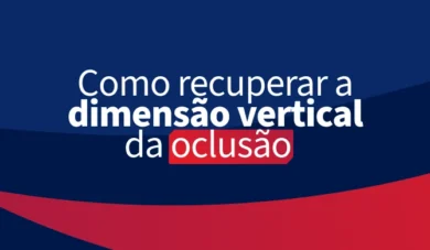 Como restabelecer a Dimensão Vertical de Oclusão?