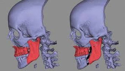 blod-dental-cremer-as-tecnologias-3d-na-ortodontia-figura01