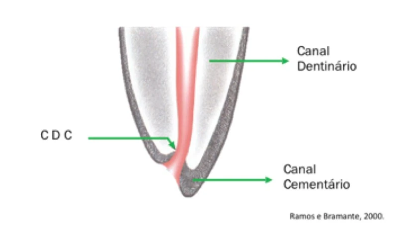 Imagem ilustrativa que mostra as partes internas do dente, incluindo canal dentinário, canal cementário e limite cdc, essenciais na anatomia dental.