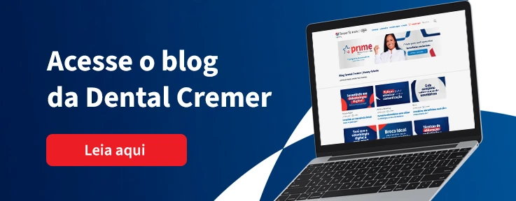 Banner digital promovendo o blog da Dental Cremer, com instruções para acessar o site e um botão de chamada para ação 'Leia aqui'. A imagem mostra um laptop exibindo o site da Dental Cremer | Henry Schein.