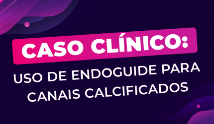 Endoguide: Uso para a endodontia de canais calcificados