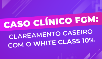 Clareamento caseiro: supervisionado com peróxido de hidrogênio 10%