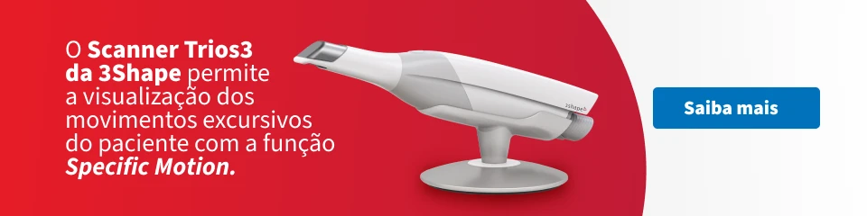 Imagem do Scanner Trios3 da 3Shape, dispositivo odontológico utilizado para visualizar movimentos musculares com precisão durante exames de pacientes.