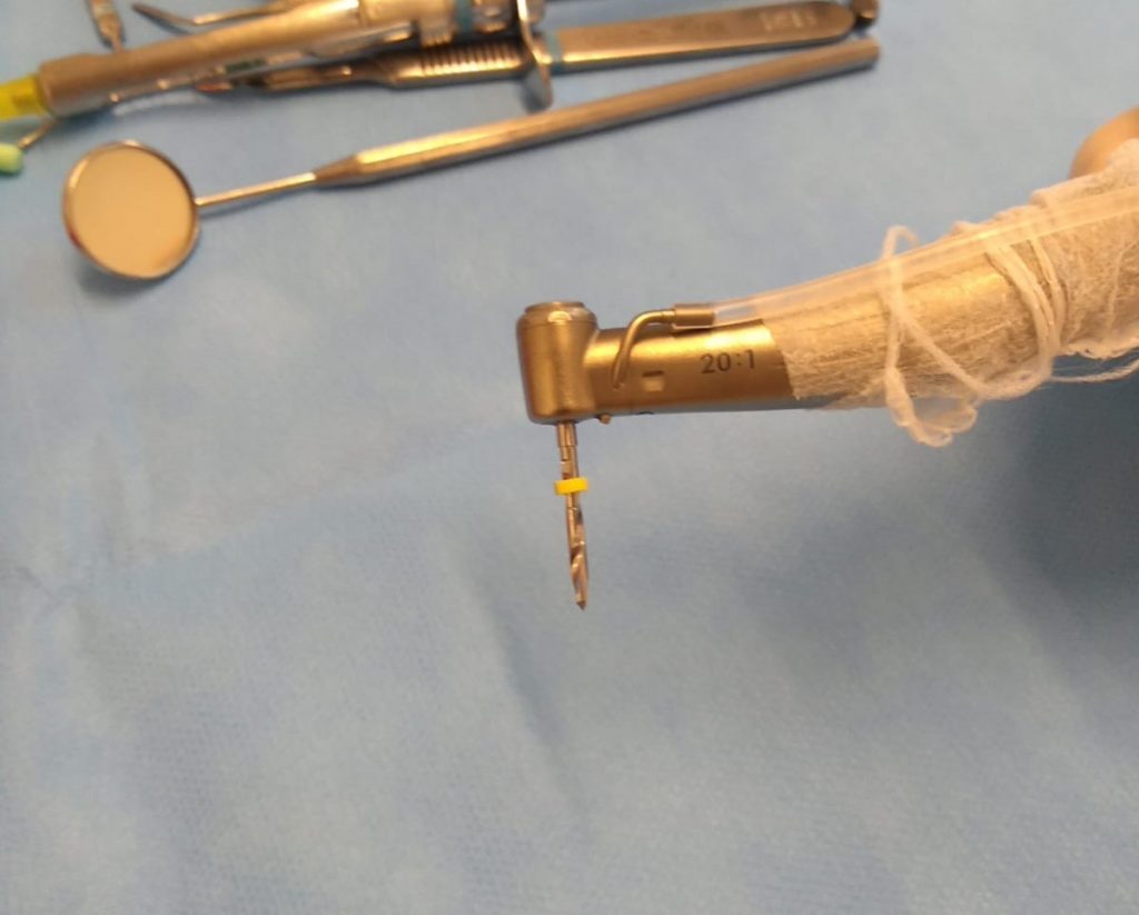 stop de brocas para instalação de implantes