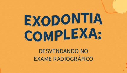 Exodontia complexa: Sinais radiográficos que te ajudam a identificar