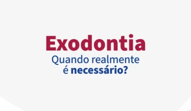 Exodontia: O que é, Tipos, Indicações e Guia Completo para o Cirurgião-Dentista