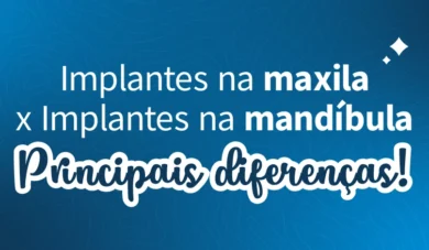 Principais diferenças da cirurgia de Implantes na maxila e na mandíbula
