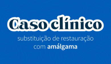 Caso do molar: restauração oclusal com resina bulk