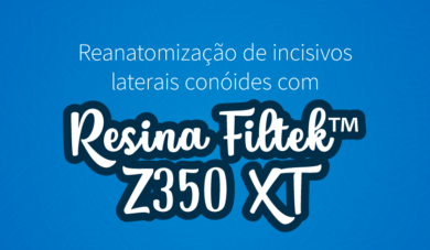 Caso clínico: Reanatomização de incisivos laterais conóides