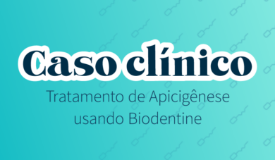 Tratamento de Apicigênese: Caso clínico utilizando Biodentine™!