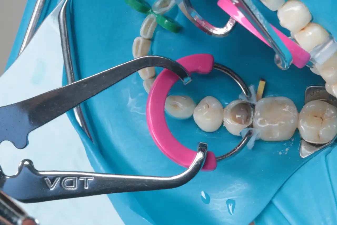Procedimento odontológico com instrumentos cirúrgicos e dentes artificiais em ação na clínica de saúde bucal.