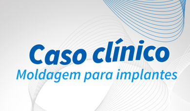 Moldagem para implantes com Resinlay Pattern Photo