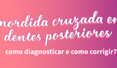 Como corrigir uma mordida cruzada posterior? Veja aqui!