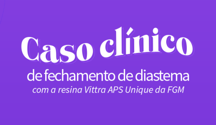 Caso clínico de fechamento de diastemas com Vittra APS Unique