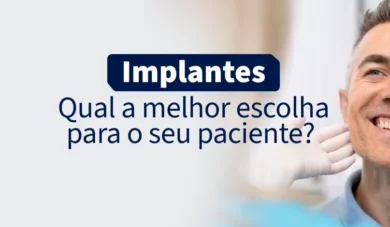 Como escolher o tamanho de implantes dentários