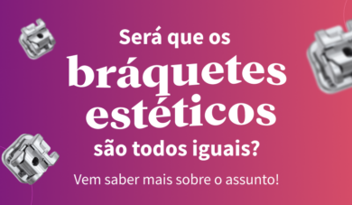 Os bráquetes estéticos são todos iguais?