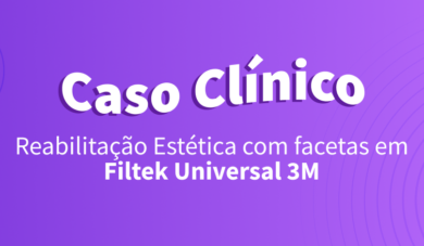 Caso Clínico de Reabilitação Estética com facetas em Filtek Universal 3M