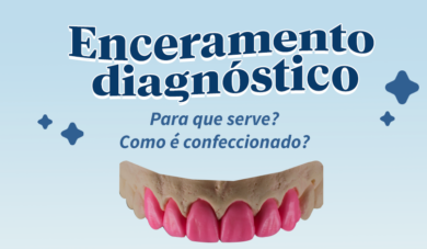 Enceramento diagnóstico como ferramenta no tratamento restaurador indireto