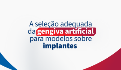 Gengiva artificial em implantes dentários: Escolha e aplicações corretas