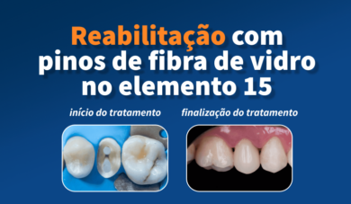 Caso clínico: Paciente com extensa perda de estrutura dentária