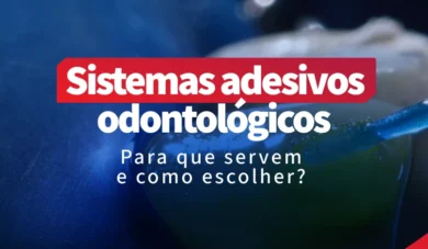 Sistemas adesivos odontológicos: para que servem e como escolher?