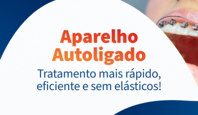 Saiba mais sobre o aparelho ortodôntico autoligado