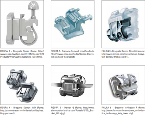 tipos de braquetes autoligados